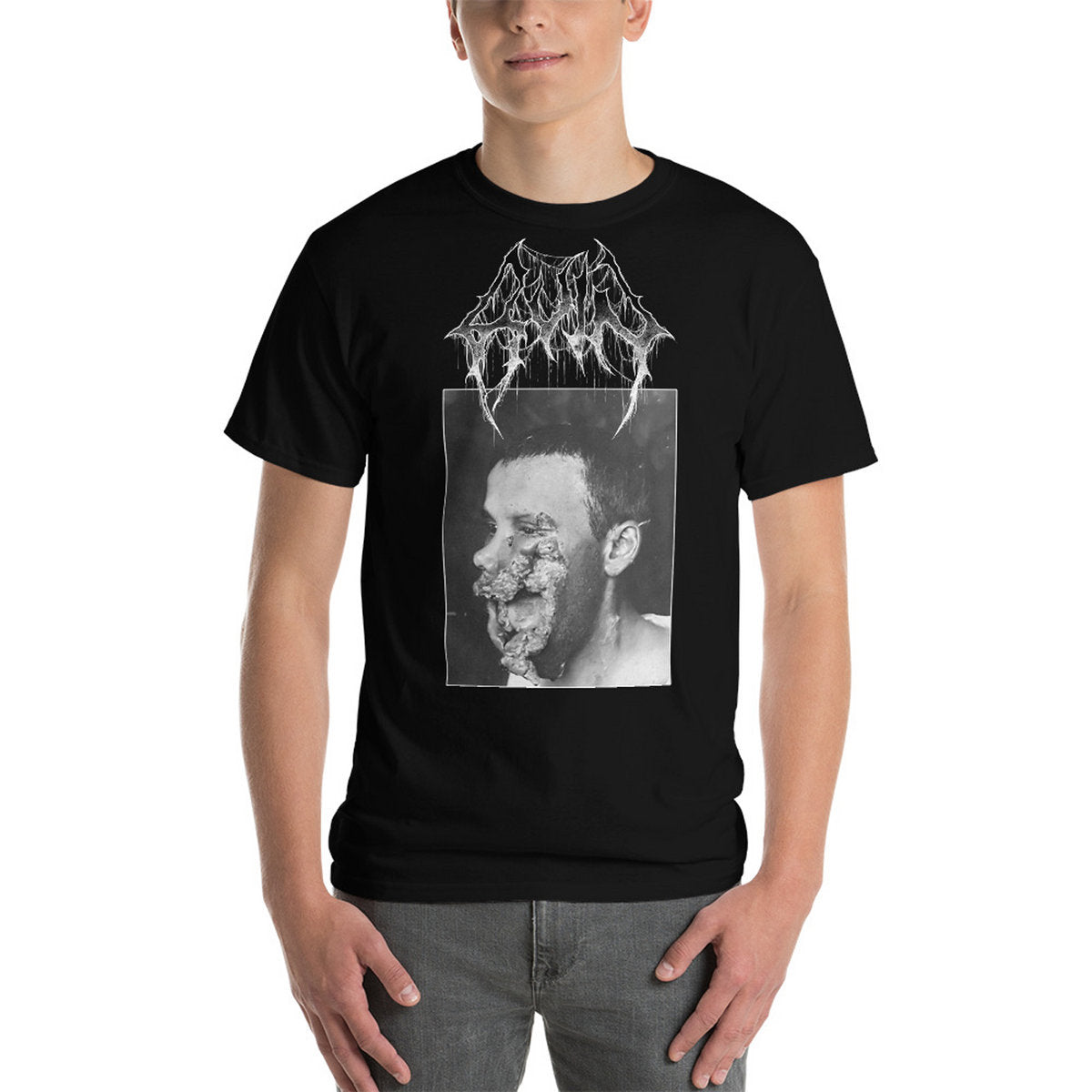 RUIN - Rotting Mouth T-Shirt