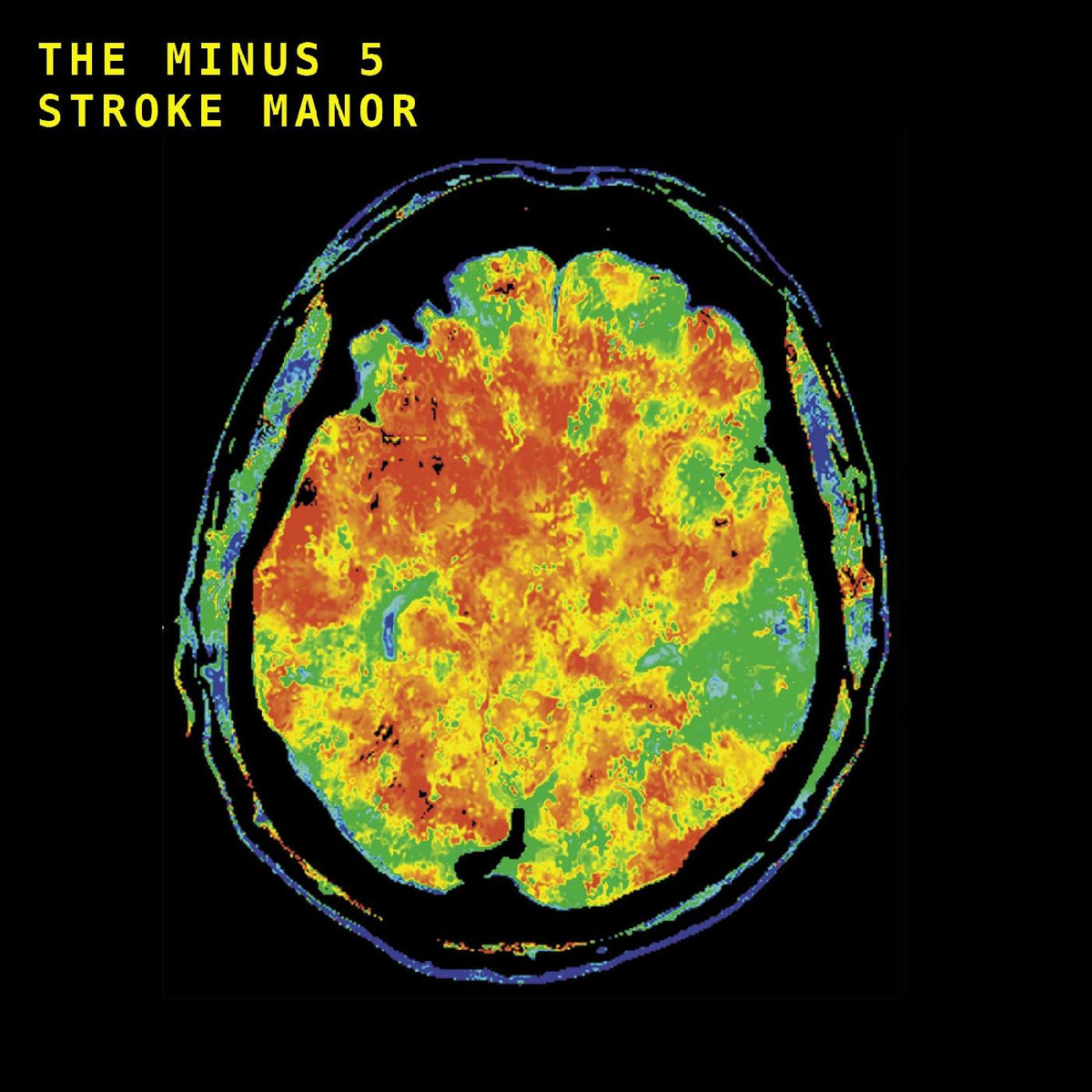 Minus 5, The - Stroke Manor (INDIE EXCLUSIVE, RED, ORANGE, YELLOW BRAINWAVE VINYL) [Vinyl]