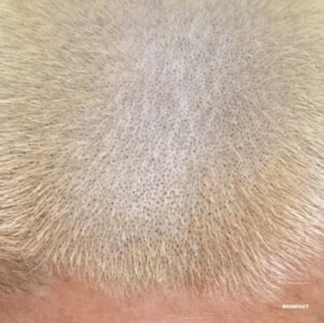 Barnt - Prometal Fan Decor Only Product - 12 Inch Vinyl