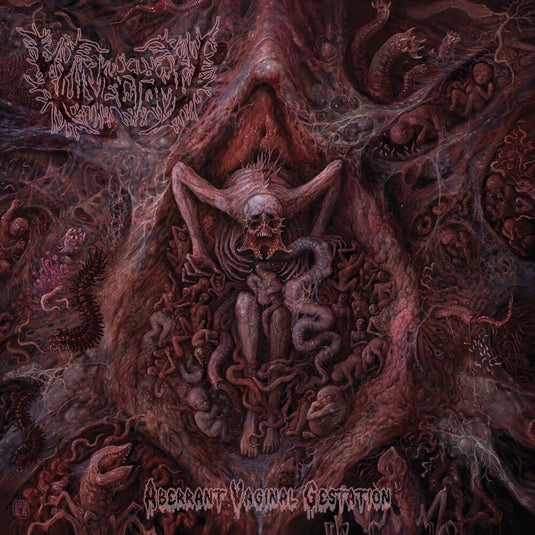 the album cover for Vulvectomy - Aberrant Vaginal Gestation