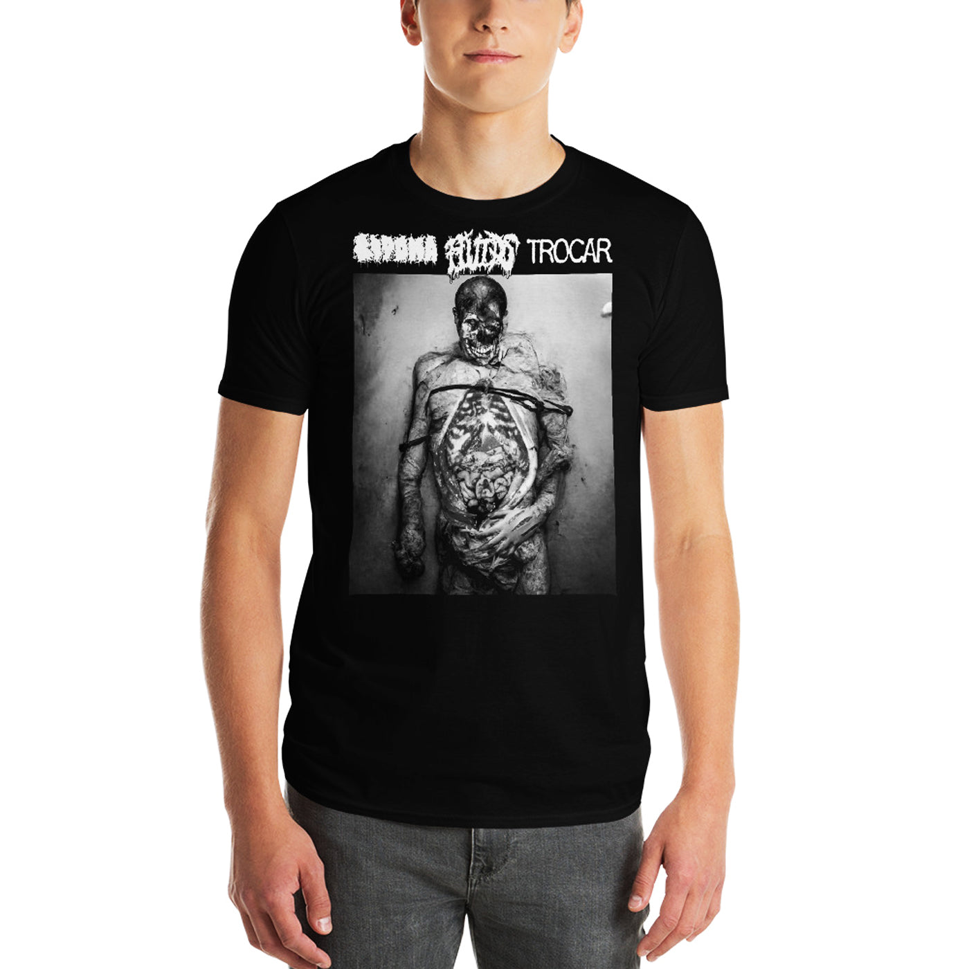 LIPOMA / FLUIDS / TROCAR - Dissertations Black & White T-Shirt