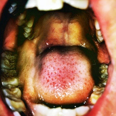 Public Storage (Clear and White Marbled) [Vinyl]